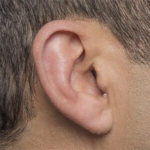 invisible-in-canal-hearing-aid-in-the-ear